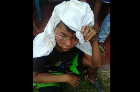 Menor queda desfigurado tras ser golpeado por su vecino