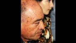 Lambayeque: detectan 10 lesiones precancerosas a Roberto Torres
