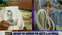 La Victoria: anciano sigue grave por ataque de adicto en parque