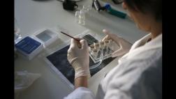 Madre de Dios: reportan primer caso autóctono de chikungunya