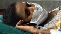 Al año se registran 27 mil nuevos casos de tuberculosis en Perú