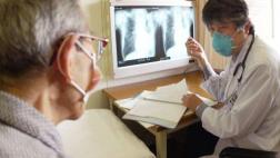 Mayoría de casos de tuberculosis se pueden prevenir y curar