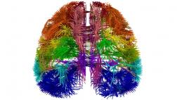 Cuando el cerebro nos engaña