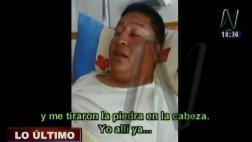 Tayacaja: este es el testimonio de uno de los policías heridos
