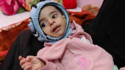 Los rostros y las voces de la devastadora guerra en Yemen
