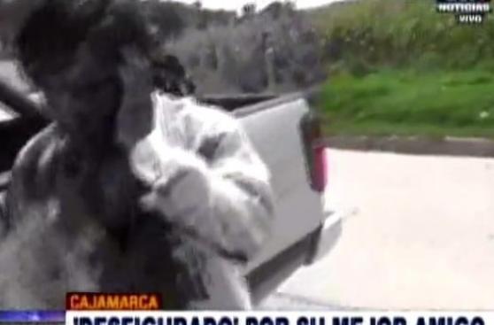 Discutió con su amigo y le desfiguró el rostro con una botella