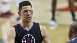 NBA: así quedó la cara de un jugador tras recibir fuerte codazo
