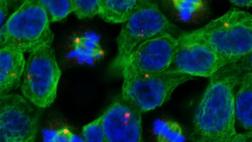 Identifican genes y mutaciones que causan cáncer de pecho