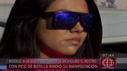 La inverosímil versión de sujeto acusado de desfigurar modelo