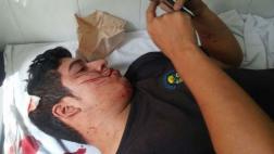La Molina: cámara captó agresión de ambulantes a fiscalizadores
