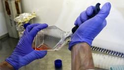 Hallan mecanismo que provoca metástasis en cáncer de próstata