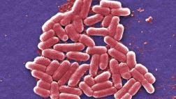 EE.UU. reporta primer caso de bacteria inmune a antibióticos