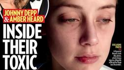 Johnny Depp: revelan foto de segunda golpiza contra Amber Heard