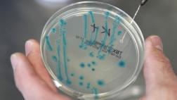 Hallan mecanismo de bacterias que potencia su poder patógeno