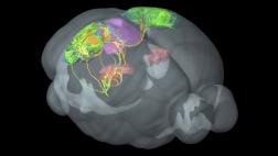Nueva alteración genética provoca parkinsonismo en menores
