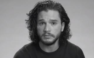 Kit Harington audicionó en "Game of Thrones" con un ojo morado