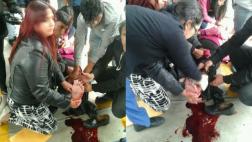 Metropolitano: mujer de 61 años sufrió accidente al abordar bus