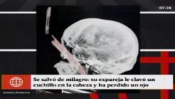 Sujeto usó guantes quirúrgicos para acuchillar a su ex pareja