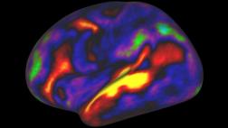 Nuevo mapa del cerebro identifica 97 regiones desconocidas