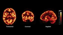Nueva técnica muestra cómo se comunican las neuronas