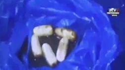 Puerto Maldonado: burrier nigeriano muere con droga en estómago