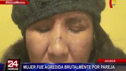 Sujeto golpeó con una plancha a su esposa y ahora está prófugo
