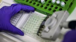 Inteligencia atificial ayuda a detectar leucemia poco común