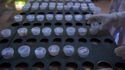 Sida: mutación genética bloquea vía de entrada del VIH