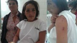 Cajamarca: ebrio quema a su pareja con 7 meses de embarazo