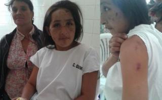 Cajamarca: ebrio quema a su pareja con 7 meses de embarazo