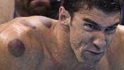 China infla el pecho por las marcas circulares de Phelps