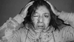 Sigue violencia contra la mujer: 6 casos en menos de una semana