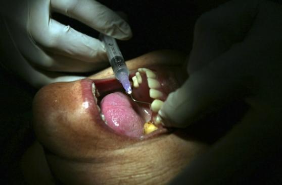 Vinculan infecciones a consultorio dental en Nueva Jersey