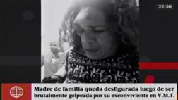 Sujeto con varias denuncias por agresión desfiguró a ex pareja