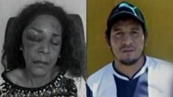 Desfiguró a ex pareja, quedó libre y víctima teme por su vida