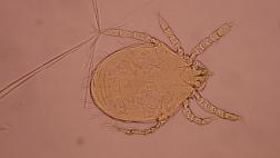 Hallan en Sudamérica la bacteria de la fiebre de los matorrales