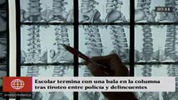 Niña fue herida por bala perdida tras persecución a ladrones