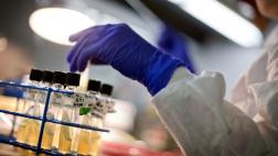 Muestran cómo bacterias se vuelven resistentes a antibióticos
