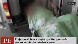 Mujer quemada por conviviente está en cuidados intensivos