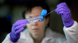 Enfermedades resistentes a antibióticos amenazan a la economía