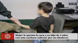 Chiclayo: buscan a madre que quemó rostro de hijo de 5 años
