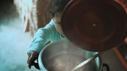 El 70% de niños quemados es por contacto con líquidos calientes