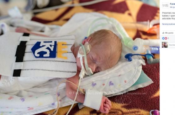 Facebook: el Halloween de bebes prematuros en hospital