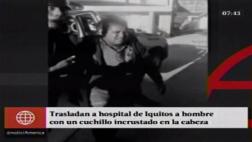 Entró caminando a hospital con cuchillo incrustado en la cabeza
