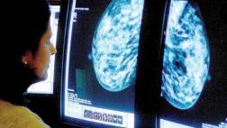 Controlan cáncer privando las células cancerosas de nutrientes