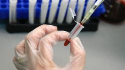 Contagio del VIH en jóvenes podría aumentar un 60% para el 2030