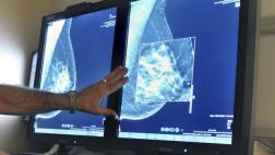 Mujeres atraviesan el Atlántico para concienciar sobre cáncer