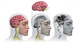 Así es el cerebro del corrupto