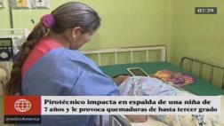 Niña de 7 años gravemente quemada por pirotécnico de vecino
