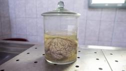 La simpatía puede estar relacionada con la forma del cerebro